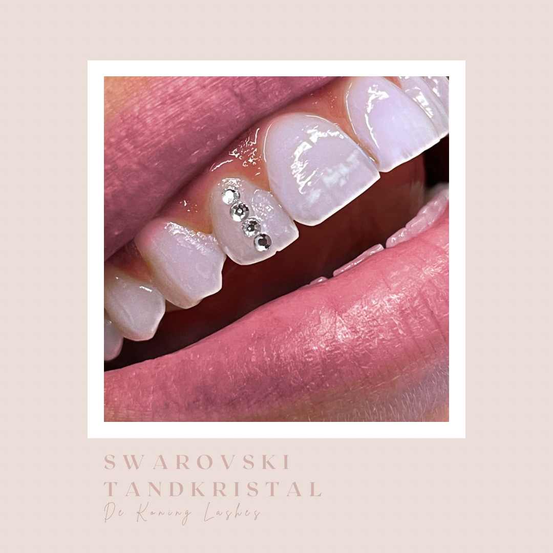 Swarovski tandkristal: drie kristallen op een voortand