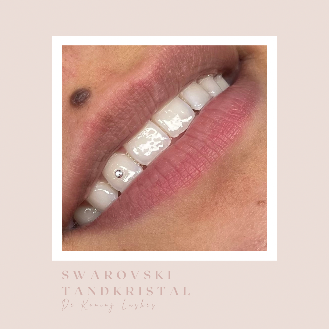 Swarovski tandkristal: kleine kristallen op twee tanden
