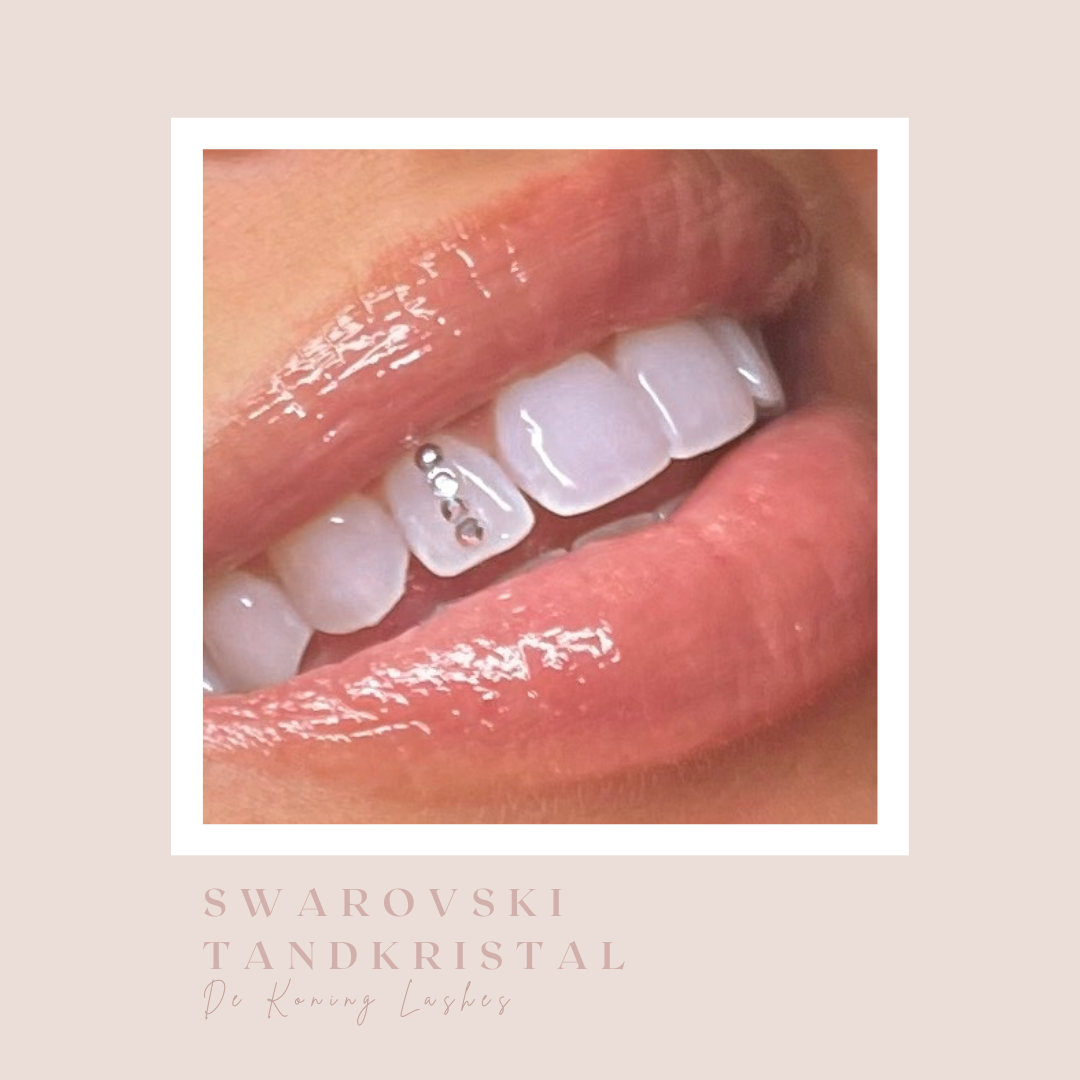 Swarovski tandkristal: een rij kristallen op een voortand